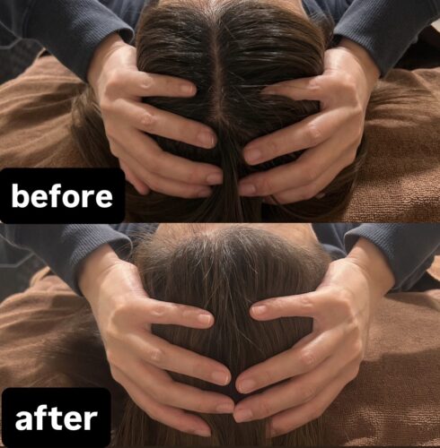 頭の張り、大きさでお悩みの方には小顔矯正がおすすめ