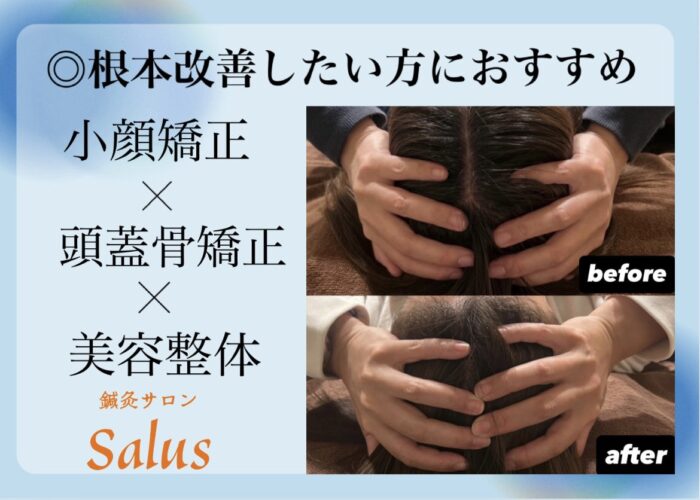 当院の小顔矯正は頭もしっかりほぐします♪